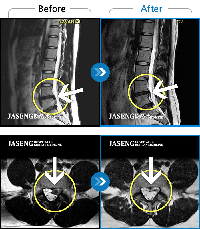 ڻѹ溴 ġ MRI  ġ- 㸮  ,  ٸ    ϼ̽ϴ.