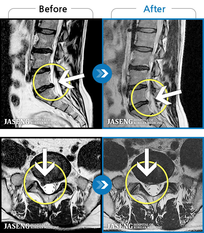 ϻڻѹ溴 ġ MRI  ġ- ݺ   ӵǸ ڼ ÿ   ȭǴ ߵ ̻  ȣϴ ¿ϴ.