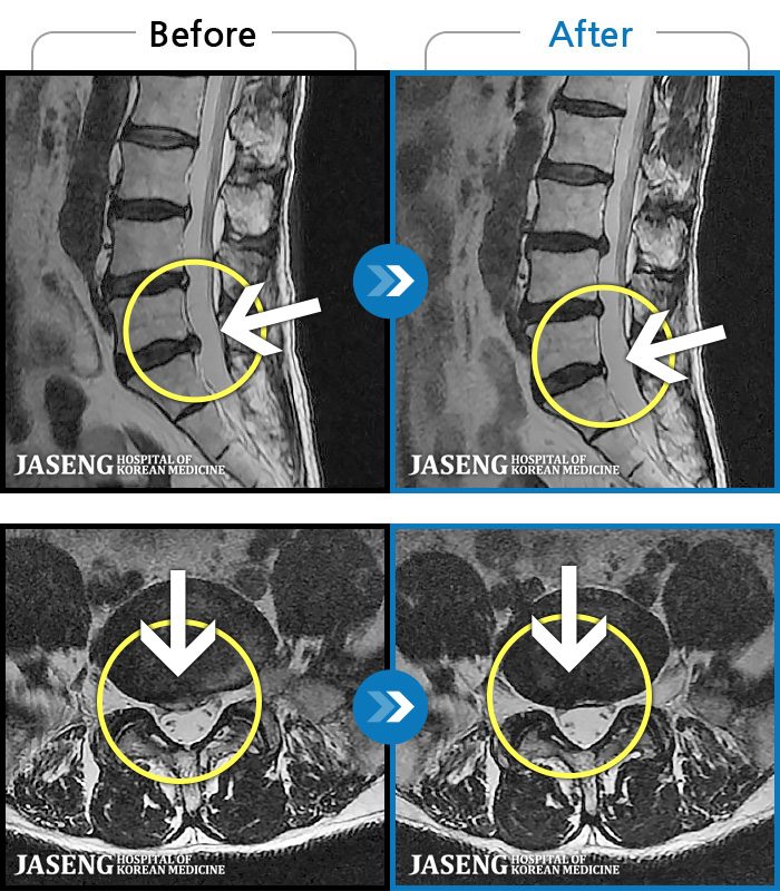 ϻڻѹ溴 ġ MRI  ġ-   ϰ     ӵǾϴ. ߰ Ͽ ߰   Ǵ  ߵ ̻  ȣϴ ¿ϴ.