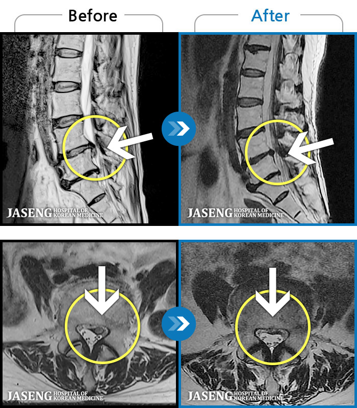 ϻڻѹ溴 ġ MRI  ġ-㸮,  ݺ  ٸ    ӵǰ  ٸ  