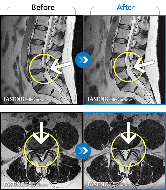 ������ڻ��ѹ溴�� ġ���� MRI�� ���� ġ����-���� �㸮���� ��ġ���� ������, �ٸ� ������ ���������� ���ϰ� ��������. 