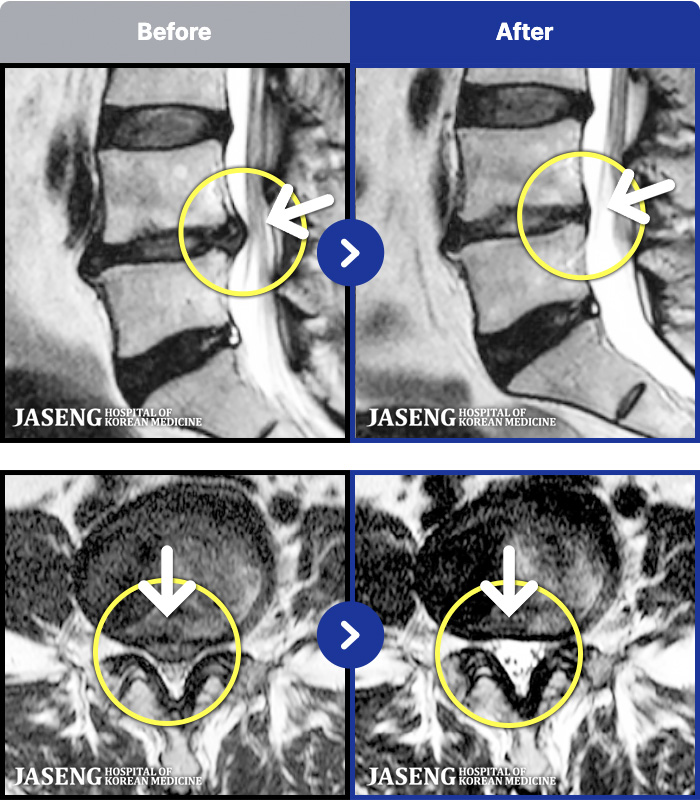 ڻѹ溴 ġ MRI ġ-ؽ ð ɾ ְų ִ ڼ ¿.