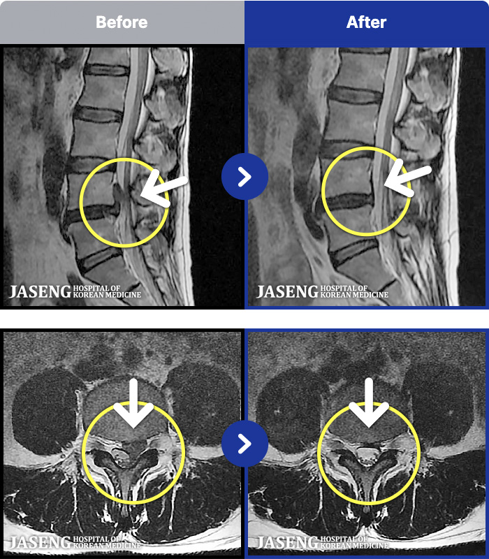 �ϻ��ڻ��ѹ溴�� ġ���� MRI�� ���� ġ����-��ð� ���� �� ���� �ɾ� �ִ� ������ ���� �㸮��ũ�� �ߺ��Ͽ����ϴ�.