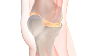 일산자생한방병원 무릎질환 무릎점액낭염-무릎점액낭염 관련 사진 입니다.