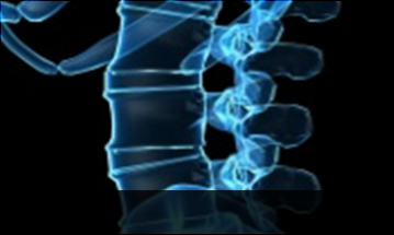 일산자생한방병원 허리질환 척추전방전위증-정상적인 사람의 척추뼈 모습입니다.