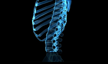 일산자생한방병원 허리질환 척추전만증-정상적인 사람의 척추 모습입니다.